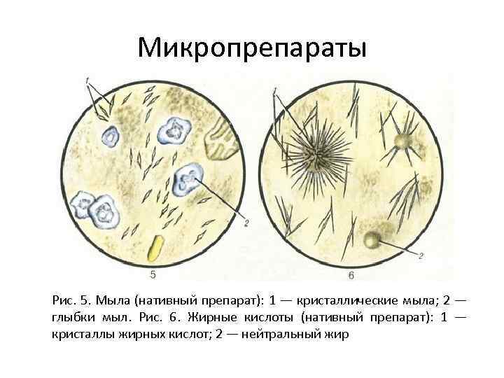 Микропрепараты Рис. 5. Мыла (нативный препарат): 1 — кристаллические мыла; 2 — глыбки мыл.