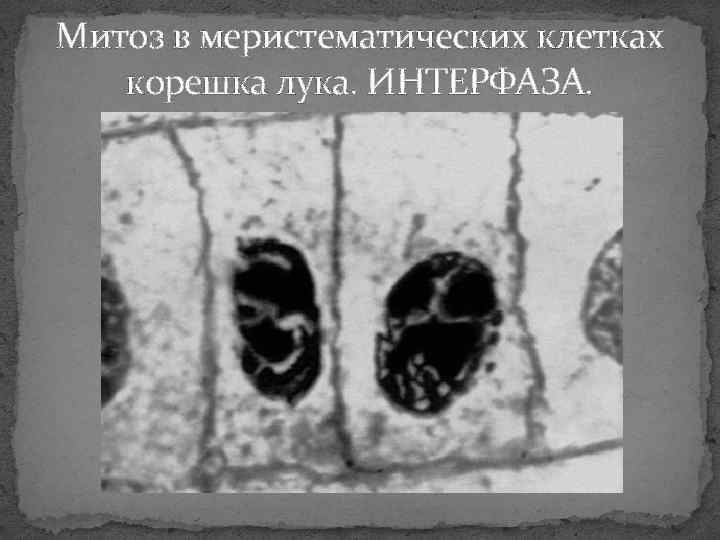 Митоз в меристематических клетках корешка лука. ИНТЕРФАЗА. 
