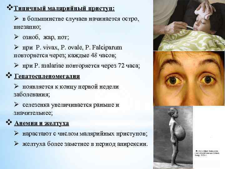 v. Типичный малярийный приступ: Ø в большинстве случаев начинается остро, внезапно; Ø озноб, жар,