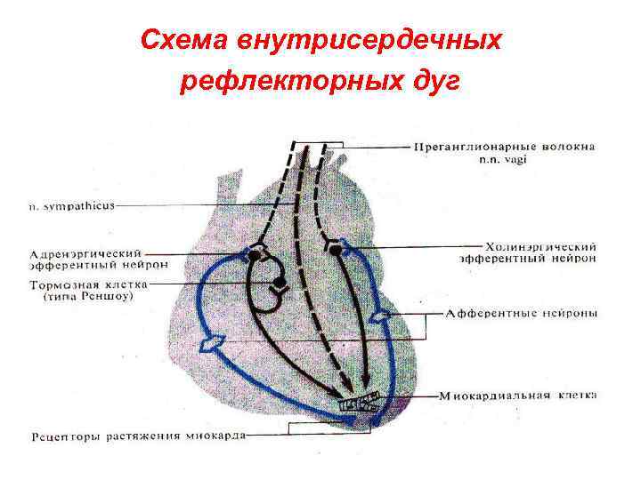 Внутрисердечный тромбоз