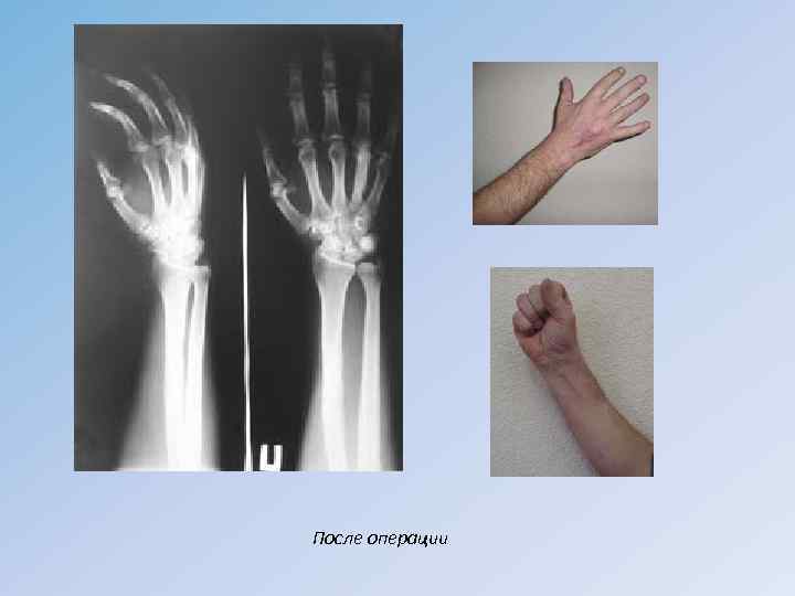 После операции 