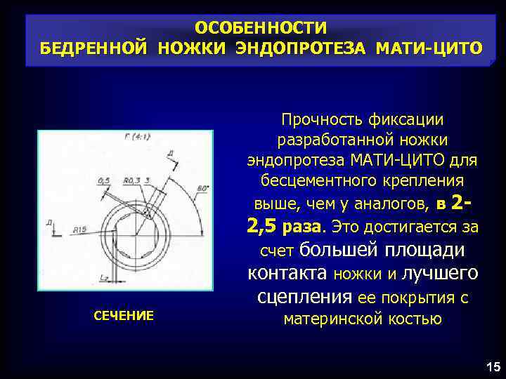 ОСОБЕННОСТИ БЕДРЕННОЙ НОЖКИ ЭНДОПРОТЕЗА МАТИ-ЦИТО СЕЧЕНИЕ Прочность фиксации разработанной ножки эндопротеза МАТИ-ЦИТО для бесцементного