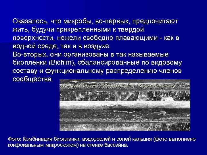 Оказалось, что микробы, во-первых, предпочитают жить, будучи прикрепленными к твердой поверхности, нежели свободно плавающими