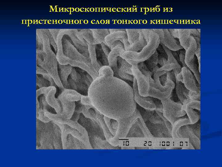 Микроскопический гриб из пристеночного слоя тонкого кишечника 