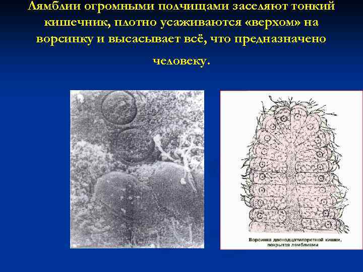 Лямблии огромными полчищами заселяют тонкий кишечник, плотно усаживаются «верхом» на ворсинку и высасывает всё,