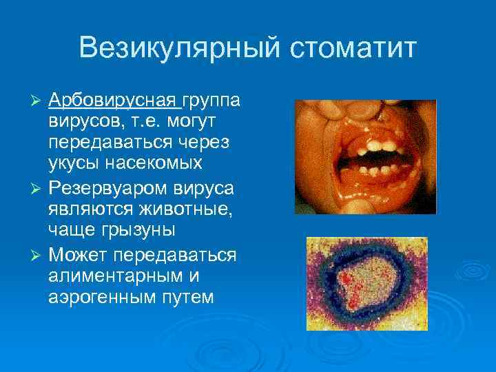 Везикулярный стоматит Арбовирусная группа вирусов, т. е. могут передаваться через укусы насекомых Ø Резервуаром