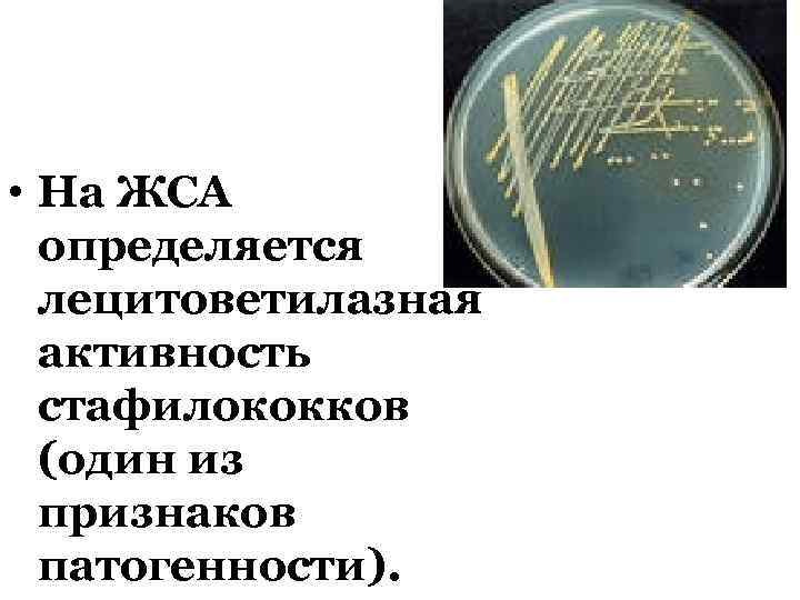  • На ЖСА определяется лецитоветилазная активность стафилококков (один из признаков патогенности). 