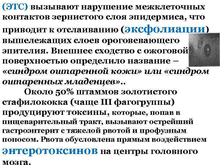 (ЭТС) вызывают нарушение межклеточных контактов зернистого слоя эпидермиса, что приводит к отслаиванию (эксфолиации) вышележащих
