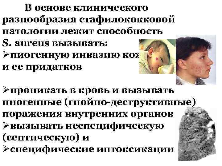 В основе клинического разнообразия стафилококковой патологии лежит способность S. aureus вызывать: Øпиогенную инвазию кожи