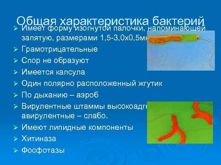 Общая характеристиканапоминающей бактерий Ø Имеет форму изогнутой палочки, Ø Ø Ø Ø Ø запятую,