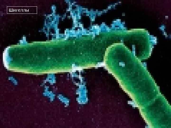 Шигеллы 