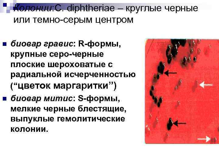 Колонии: C. diphtheriae – круглые черные или темно-серым центром n n биовар гравис: R-формы,