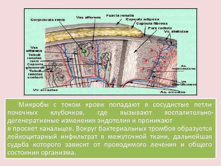 Микробы с током крови попадают в сосудистые петли почечных клубочков, где вызывают воспалительнодегенеративные изменения