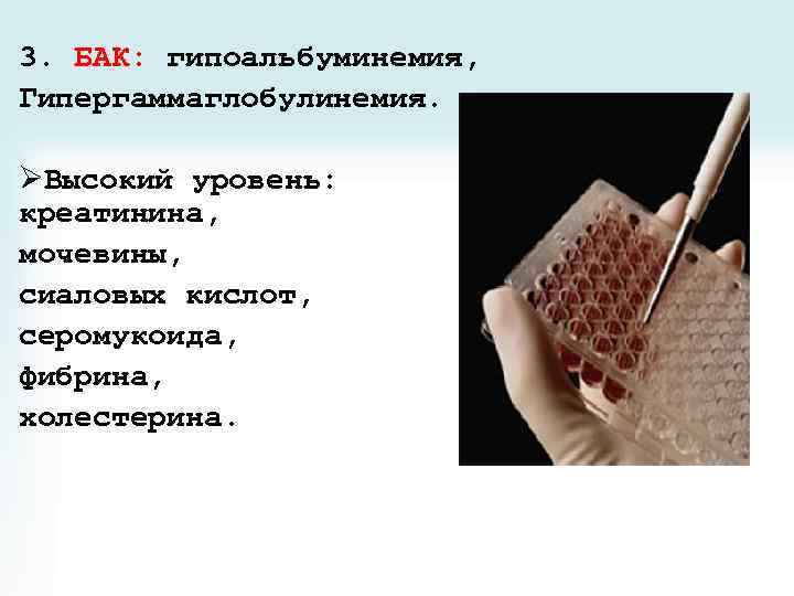 3. БАК: гипоальбуминемия, Гипергаммаглобулинемия. ØВысокий уровень: креатинина, мочевины, сиаловых кислот, серомукоида, фибрина, холестерина. 