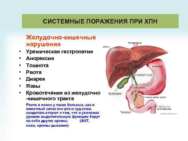 СИСТЕМНЫЕ ПОРАЖЕНИЯ ПРИ ХПН Желудочно-кишечные нарушения • • Уремическая гастропатия Анорексия Тошнота Рвота Диарея