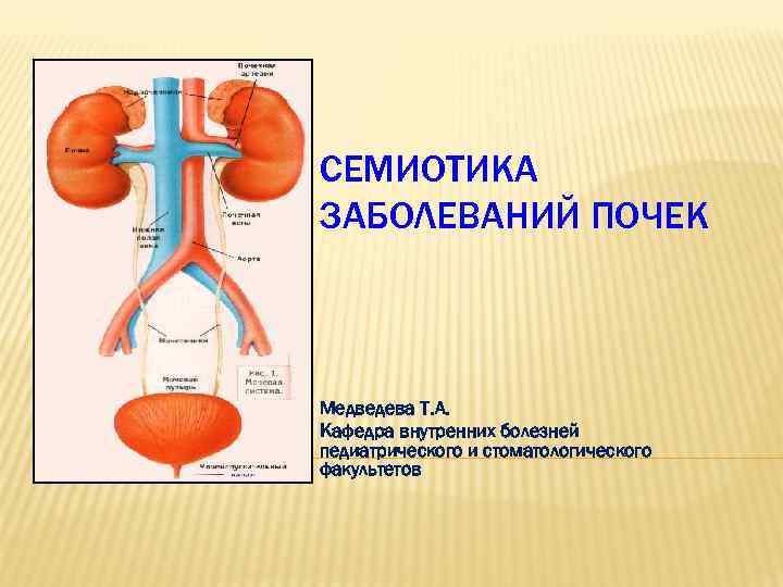 Лучевая семиотика заболеваний органов мочевыделительной системы презентация