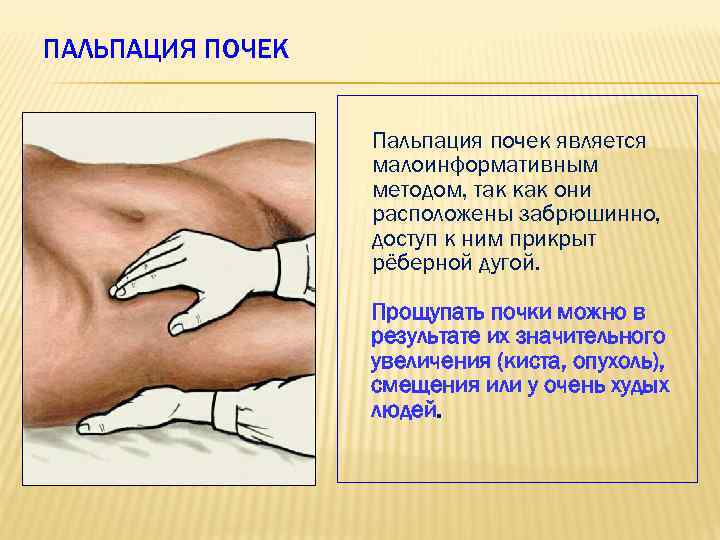ПАЛЬПАЦИЯ ПОЧЕК Пальпация почек является малоинформативным методом, так как они расположены забрюшинно, доступ к