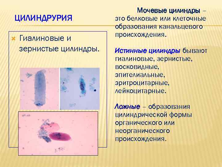 ЦИЛИНДРУРИЯ Гиалиновые и зернистые цилиндры. Мочевые цилиндры – это белковые или клеточные образования канальцевого