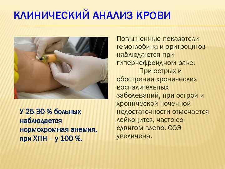 КЛИНИЧЕСКИЙ АНАЛИЗ КРОВИ У 25 -30 % больных наблюдается нормохромная анемия, при ХПН –