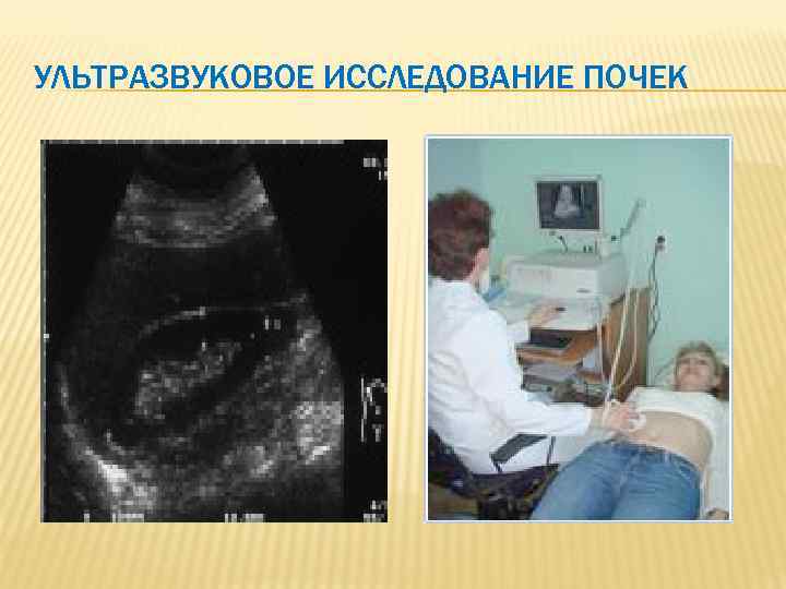 УЛЬТРАЗВУКОВОЕ ИССЛЕДОВАНИЕ ПОЧЕК 