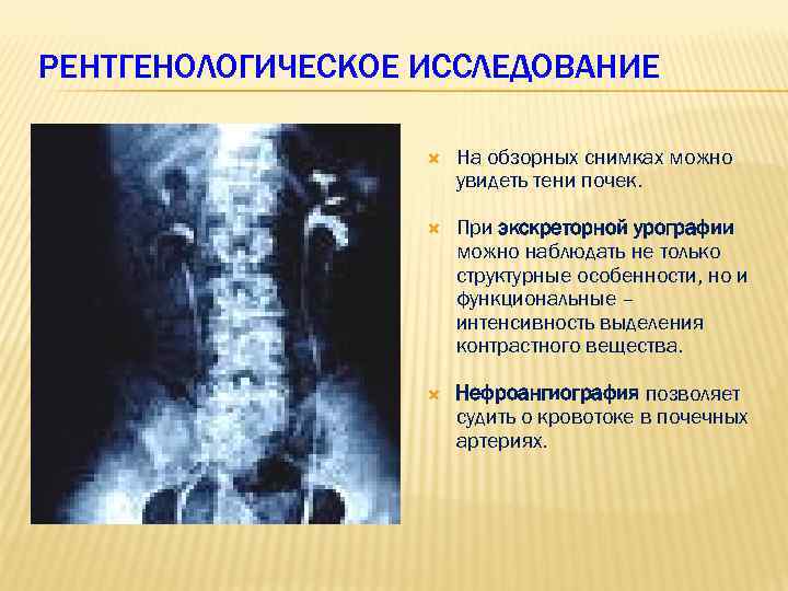 РЕНТГЕНОЛОГИЧЕСКОЕ ИССЛЕДОВАНИЕ На обзорных снимках можно увидеть тени почек. При экскреторной урографии можно наблюдать