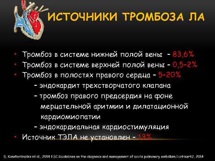 ИСТОЧНИКИ ТРОМБОЗА ЛА • Тромбоз в системе нижней полой вены – 83, 6% •