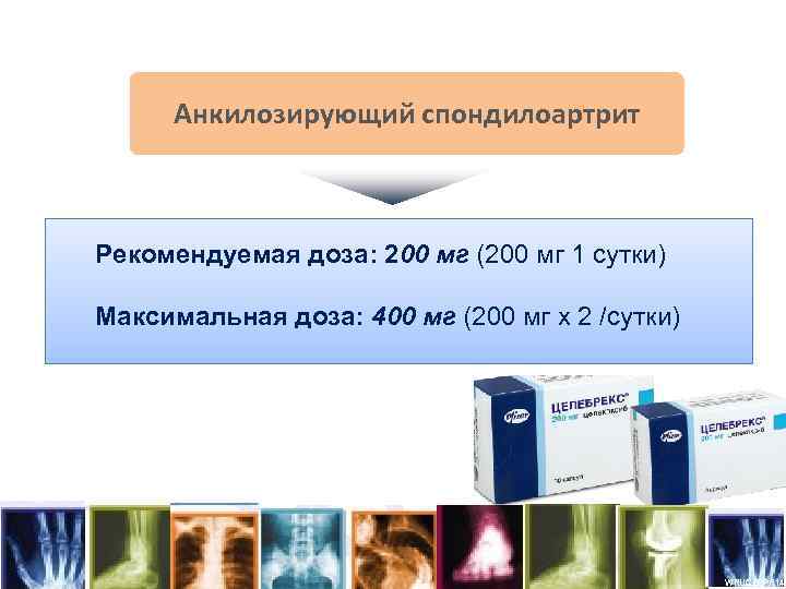 Терапевтический потенциал Целебрекса в лечении болевого синдрома в ревматологии¹⁹ Анкилозирующий спондилоартрит Рекомендуемая доза: 200