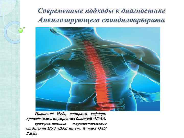 Современные подходы к диагностике Анкилозирующего спондилоартрита Иващенко Н. Ф. , аспирант кафедры пропедевтики внутренних