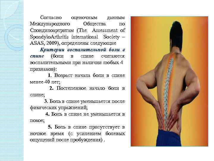 Согласно оценочным данным Международного Общества по Спондилоартритам (The Assessment of Spondylo. Arthritis international Society