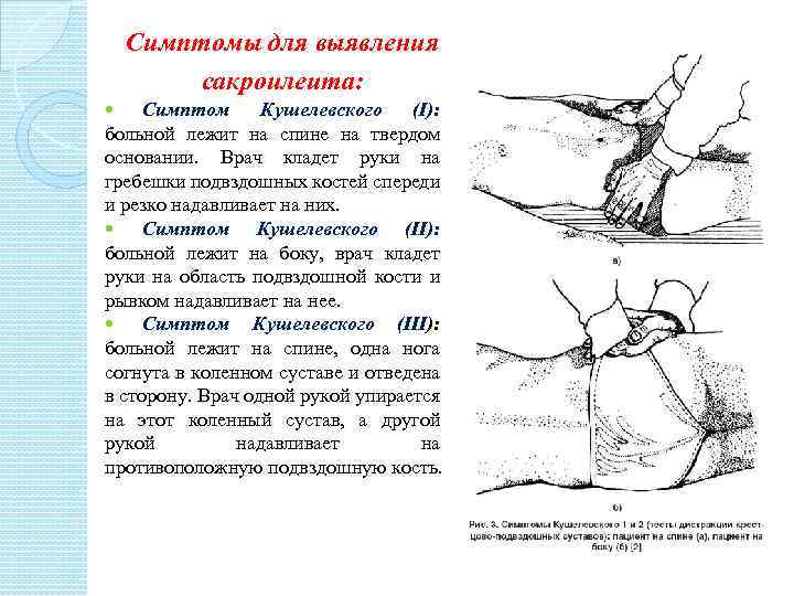 Симптомы для выявления сакроилеита: Симптом Кушелевского (I): больной лежит на спине на твердом основании.