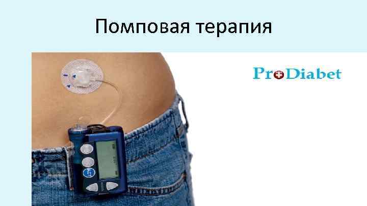 Помповая терапия 