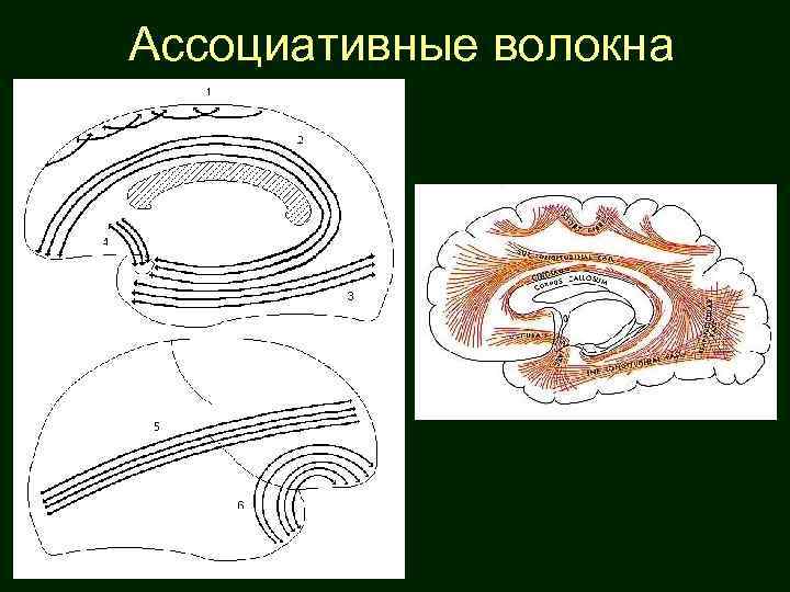 Ассоциативные волокна 