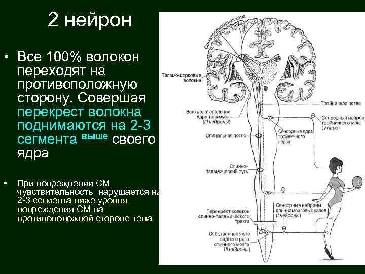 2 нейрон • Все 100% волокон переходят на противоположную сторону. Совершая перекрест волокна поднимаются