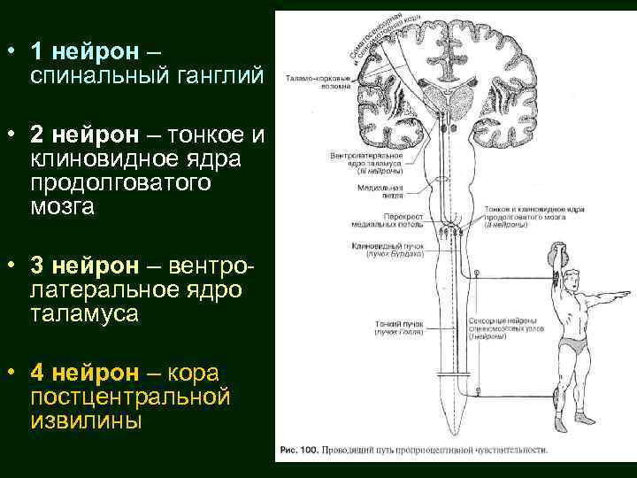  • 1 нейрон – спинальный ганглий • 2 нейрон – тонкое и клиновидное