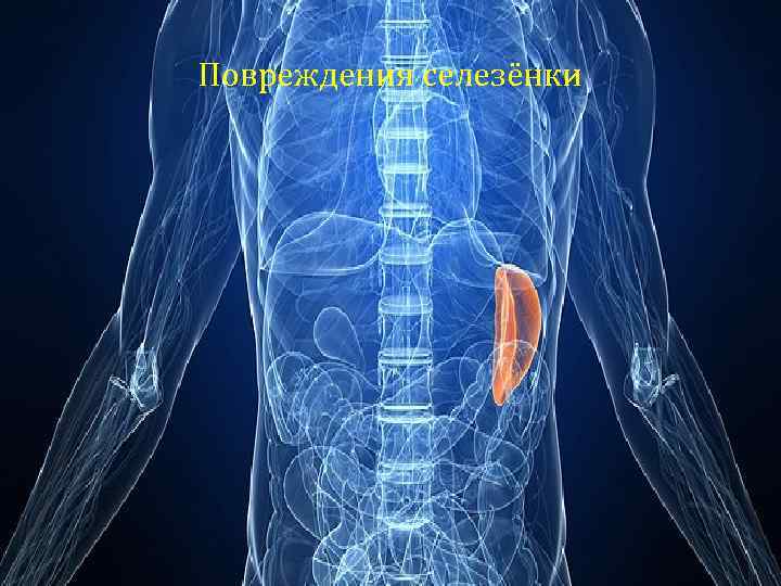 Повреждения селезёнки 