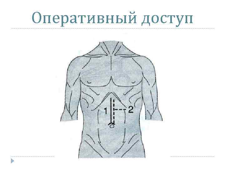 Оперативный доступ 