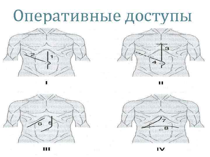 Оперативные доступы 