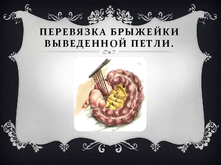 ПЕРЕВЯЗКА БРЫЖЕЙКИ ВЫВЕДЕННОЙ ПЕТЛИ. 