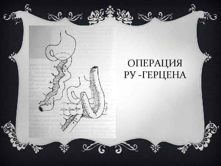 ОПЕРАЦИЯ РУ -ГЕРЦЕНА 
