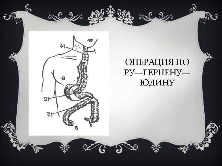 ОПЕРАЦИЯ ПО РУ—ГЕРЦЕНУ— ЮДИНУ 