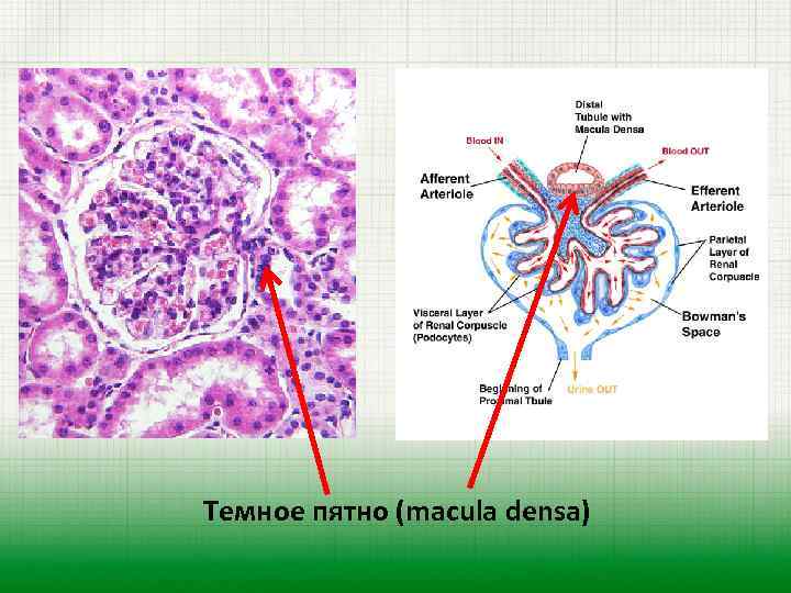 Темное пятно (macula densa) 