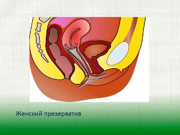 Женский презерватив 