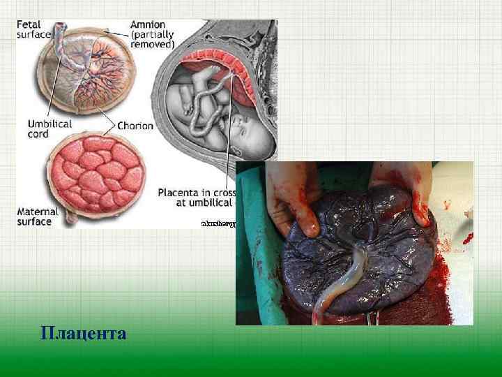 Плацента 