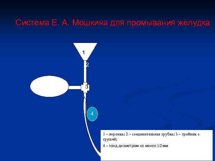 Система Е. А. Мошкина для промывания желудка 1 2 3 4 1 – воронка;