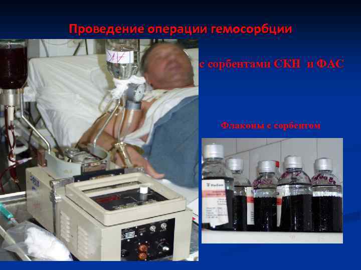 Проведение операции гемосорбции с сорбентами СКН и ФАС Флаконы с сорбентом 