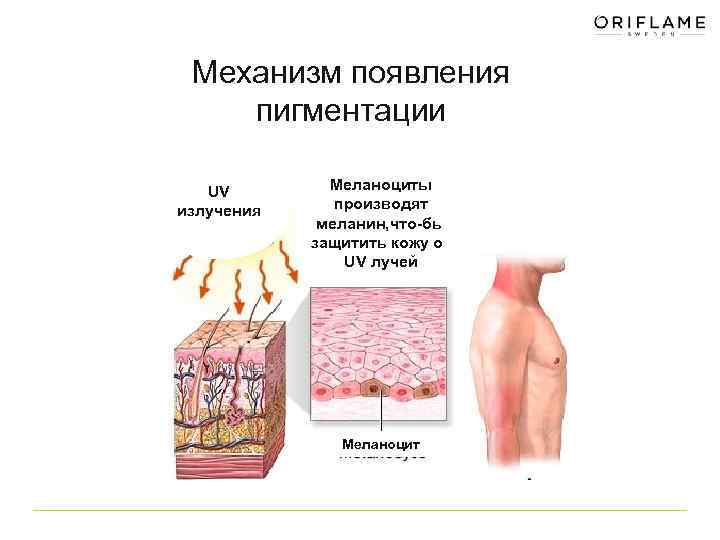 Механизм появления пигментации UV излучения Меланоциты производят меланин, что-бы защитить кожу от UV лучей
