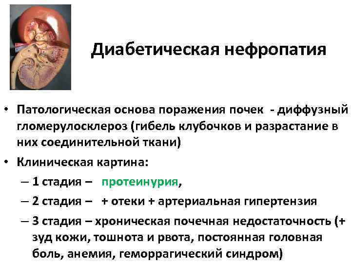 Диабетическая нефропатия • Патологическая основа поражения почек - диффузный гломерулосклероз (гибель клубочков и разрастание