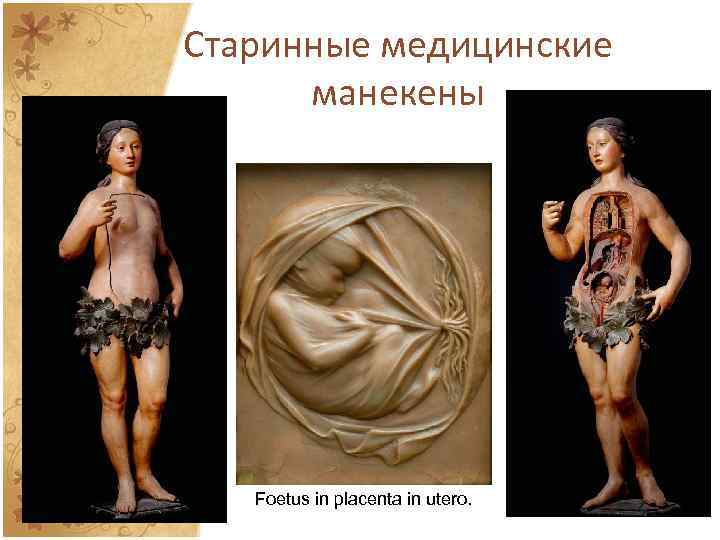 Старинные медицинские манекены Foetus in placenta in utero. 