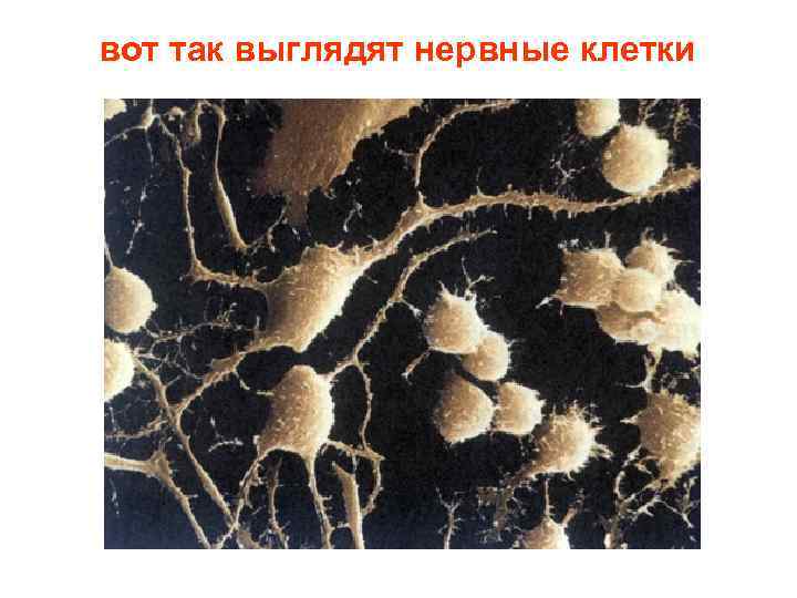 вот так выглядят нервные клетки 