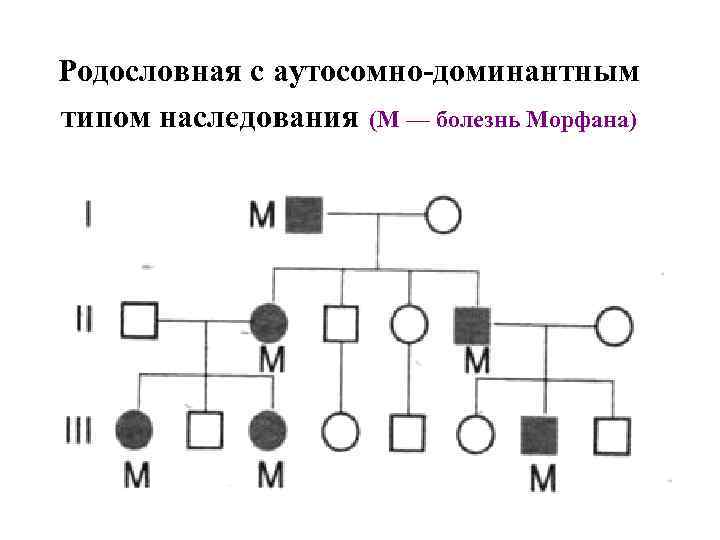 Родословная с аутосомно-доминантным типом наследования (М — болезнь Морфана) 